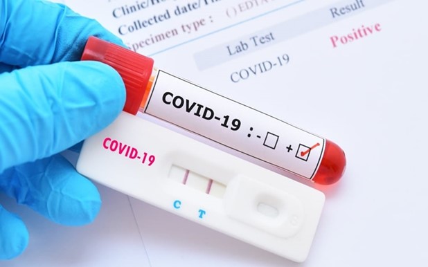 Λάρισα: Κανένα θετικό δείγμα covid-19 στα 88 rapid tests της Κοιλάδας 