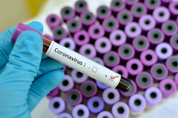 Ραγδαία αύξηση κρουσμάτων κορωνοϊού στη Λάρισα - 43 νέες μολύνσεις 